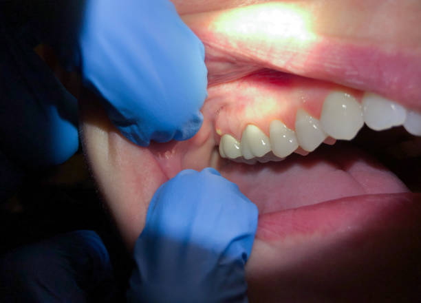 Best After-Hours Dental Trauma Care in Mcgaheysville, VA