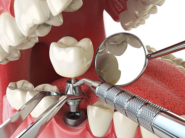 Best Same-Day Emergency Dental Services in Mcgaheysville, VA