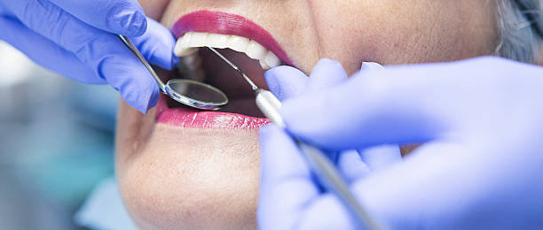 Best Emergency Dental Care for Broken or Chipped Teeth in Mcgaheysville, VA